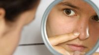 Cara Menghilangkan Jerawat di Area Hidung